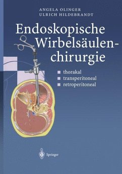 Endoskopische Wirbelsäulenchirurgie - Olinger, Angela;Hildebrandt, Ulrich