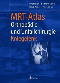 MRT-Atlas Orthopädie und Unfallchirurgie - Teller, Peter;König, Hermann;Weber, Ulrich