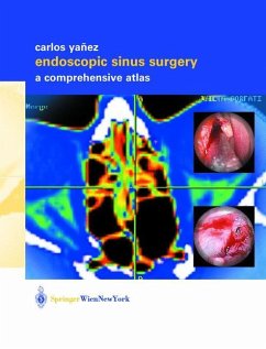 Endoscopic Sinus Surgery - Yañez, Carlos