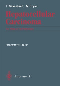 Hepatocellular Carcinoma - Nakashima, Toshiro;Kojiro, Masamichi