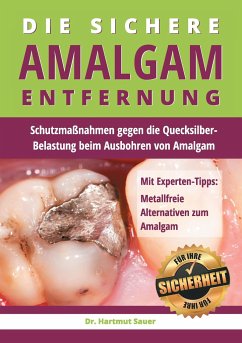 Die sichere Amalgam-Entfernung - Sauer, Hartmut