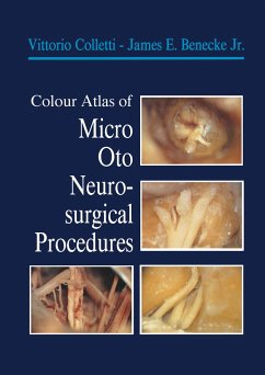Colour Atlas of Micro-Oto-Neurosurgical Procedures - Colletti, Vittorio;Benecke, James E.