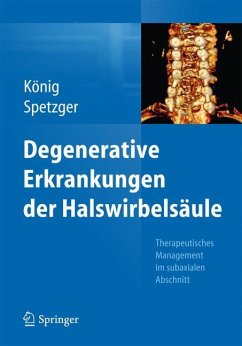 Degenerative Erkrankungen der Halswirbelsäule - König, Alexander;Spetzger, Uwe