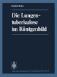 Die Lungentuberkulose im Röntgenbild - Bild 1