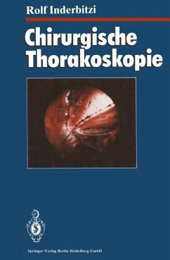 Chirurgische Thorakoskopie - Inderbitzi, Rolf Gilbert Carl
