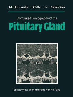 Computed Tomography of the Pituitary Gland - Bonneville, Jean-Francois;Cattin, F.;Dietemann, Jean-Louis