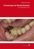 Erkrankungen der Mundschleimhaut (eBook, PDF)
