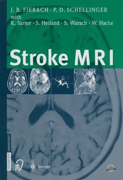 Stroke MRI - Fiebach, Jochen;Schellinger, Peter