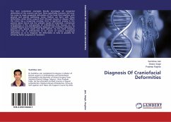 Diagnosis Of Craniofacial Deformities - Jain, Sambhav;Singh, Shishir;Raghav, Pradeep