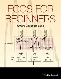 ECGs for Beginners (eBook, ePUB) - Bayés de Luna, Antoni