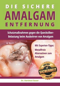Die sichere Amalgam-Entfernung (eBook, ePUB) - Sauer, Hartmut