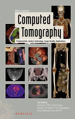 Computed Tomography (eBook, PDF) - Kalender, Willi A.