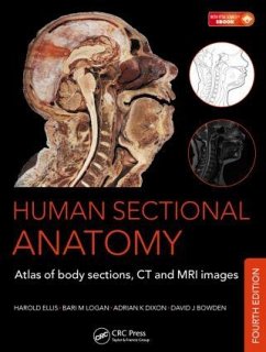 Human Sectional Anatomy - Dixon, Adrian K; Bowden, David J; Ellis, Harold; Logan, Bari M