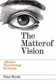 The Matter of Vision