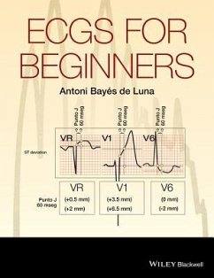 Ecgs for Beginners - Bayés de Luna, Antoni