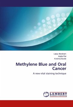 Methylene Blue and Oral Cancer