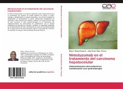 Nimotuzumab en el tratamiento del carcinoma hepatocelular