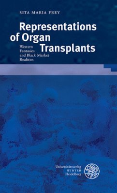 Cover Representations of Organ Transplants