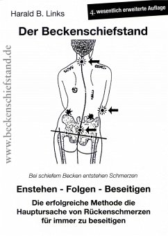 Der Beckenschiefstand (eBook, ePUB) - Links, Harald