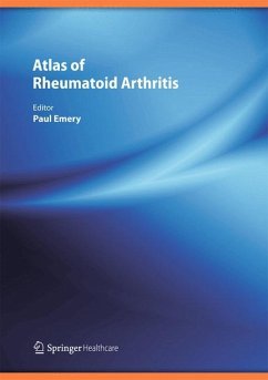 Atlas of Rheumatoid Arthritis