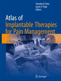 Atlas of Implantable Therapies for Pain Management