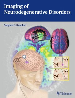 Imaging of Neurodegenerative Disorders - Kanekar, Sangam G.