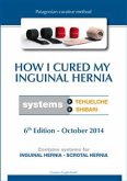 How I cured my inguinal hernia (eBook, PDF)