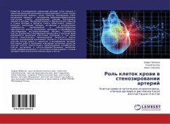 Rol' kletok krowi w stenozirowanii arterij - Gabbasov, Zufar;Kozlov, Sergey;Soboleva, Emma