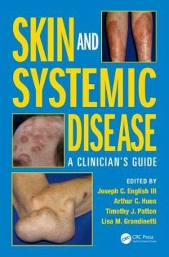 Skin and Systemic Disease - English III, Joseph C; Patton, Timothy J