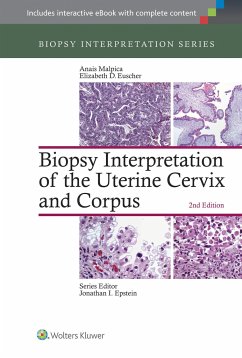 Biopsy Interpretation of the Uterine Cervix and Corpus - Malpica, Anais; Euscher, Elizabeth D.