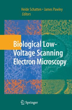 Biological Low-Voltage Scanning Electron Microscopy