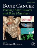 Bone Cancer (eBook, ePUB)