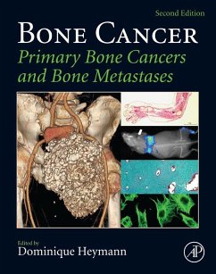 Bone Cancer (eBook, ePUB) Cover Bone Cancer (eBook, ePUB)