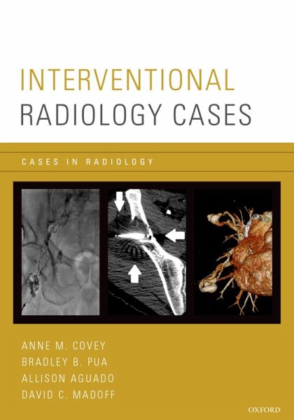 Interventional Radiology Cases (eBook, PDF) Interventional Radiology Cases (eBook, PDF)