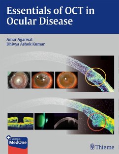 Essentials of Oct in Ocular Disease - Agarwal, Amar
