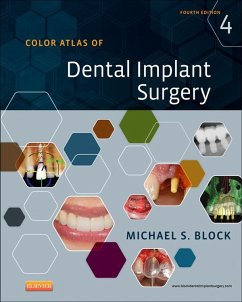 Color Atlas of Dental Implant Surgery - E-Book (eBook, ePUB) - Block, Michael S.