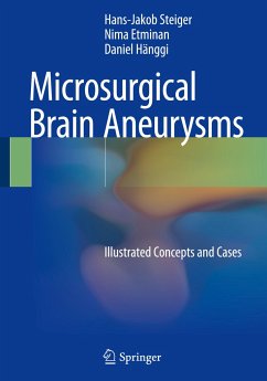 Microsurgical Brain Aneurysms - Steiger, Hans-Jakob;Etminan, Nima;Hänggi, Daniel