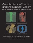 Complications in Vascular and Endovascular Surgery (eBook, ePUB)