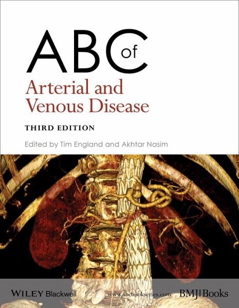 ABC of Arterial and Venous Disease (eBook, ePUB) ABC of Arterial and Venous Disease (eBook, ePUB)