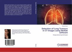 Detection of Lung Tumours in CT Images using Matlab software