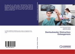 Dentoalveolar Distraction Osteogenesis - Acharya, Swati Saraswata;Patnaik, Satyabrata;Akheel, Mohammad