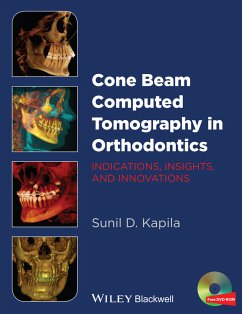 Cone Beam Computed Tomography in Orthodontics (eBook, PDF) - Kapila, Sunil