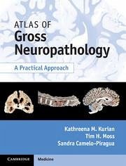 Atlas of Gross Neuropathology Book and Online Bundle - Kurian, Kathreena M; Moss, Tim H; Camelo-Piragua, Sandra