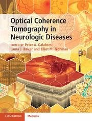 Cover Optical Coherence Tomography in Neurologic Diseases