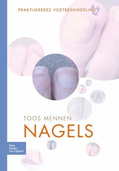 Nagels - Mennen, Toos