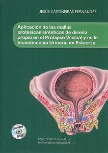 Aplicación de las mallas protésicas sintéticas de diseño propio en el prolapso vesical y en la incontinencia urinaria de esfuerzo - Castiñeiras Fernández, Jesús
