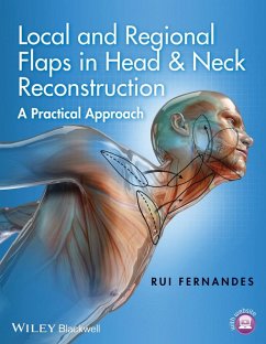 Local and Regional Flaps in Head and Neck Reconstruction (eBook, ePUB) - Fernandes, Rui