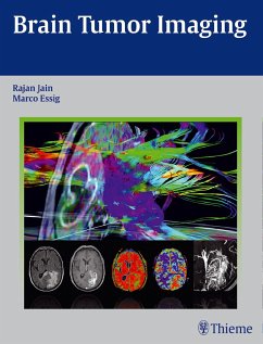 Brain Tumor Imaging - Jain, Rajan;Essig, Marco