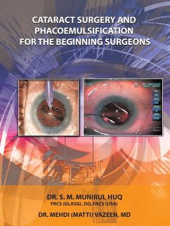 Cataract Surgery And Phacoemulsification For The Beginning Surgeons - Huq, S. M. Munirul; Vazeen, Mehdi