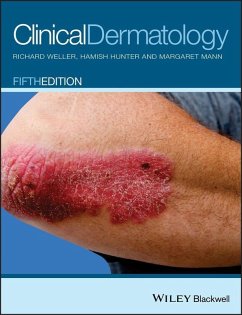 Clinical Dermatology (eBook, PDF) - Weller, Richard; Hunter, Hamish; Mann, Margaret W.